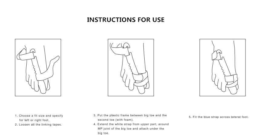 New Bunion Hallux Valgus Splint