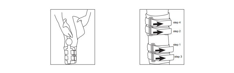 Leg Braces After Knee Surgery Instructions