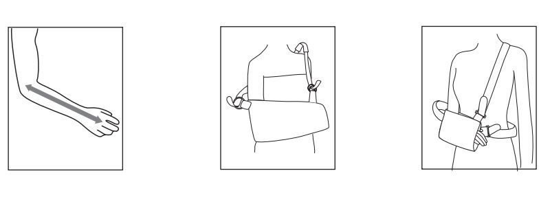 Arm Sling Support Instructions