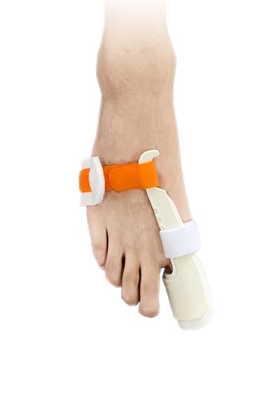 Hallux Valgus Splint