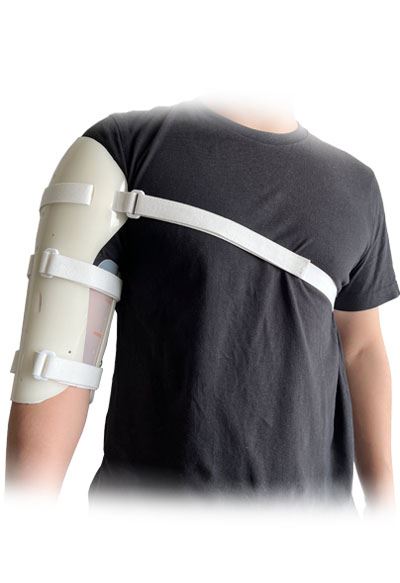 Over Shoulder Humeral Brace