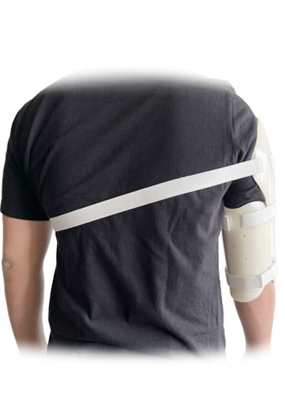 Back of the Over Shoulder Humeral Splint